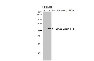 Anti-Mpox virus E9L antibody [HL5618] used in Western Blot (WB). GTX646300