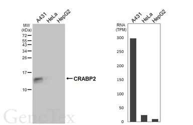 Anti-CRABP2 antibody [HL5622] used in Western Blot (WB). GTX646311