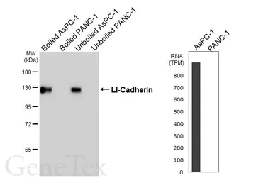 Anti-LI-Cadherin antibody [HL5636] used in Western Blot (WB). GTX646325