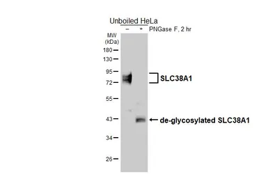 Anti-SLC38A1 antibody [HL5650] used in Western Blot (WB). GTX646459