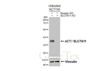 Anti-xCT / SLC7A11 antibody [HL5661] used in Western Blot (WB). GTX646470