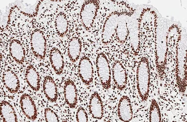 Anti-HNRNPA3 antibody [HL5675] used in IHC (Paraffin sections) (IHC-P). GTX646484
