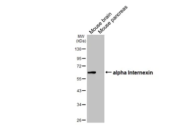 Anti-alpha Internexin antibody [HL5689] used in Western Blot (WB). GTX646520