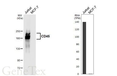 Anti-CD45 antibody [HL5696] used in Western Blot (WB). GTX646527