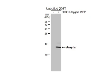 Anti-Amylin antibody [HL5701] used in Western Blot (WB). GTX646532