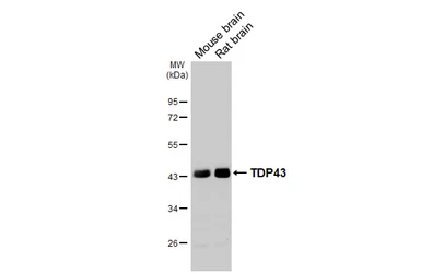 Anti-TDP43 antibody [HL5704] used in Western Blot (WB). GTX646535