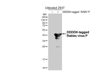 Anti-Rabies virus P antibody [HL5709] used in Western Blot (WB). GTX646540