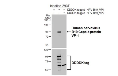 Anti-Human parvovirus B19 VP1 antibody [HL5713] used in Western Blot (WB). GTX646544