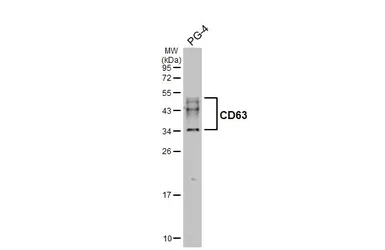 Anti-CD63 antibody [GT368] used in Western Blot (WB). GTX646552