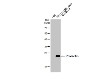 Anti-Prolactin antibody [HL5727] used in Western Blot (WB). GTX646678