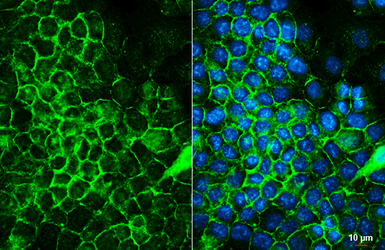 Anti-CD99 antibody [HL5738] used in Immunocytochemistry/ Immunofluorescence (ICC/IF). GTX646689