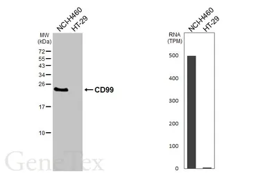 Anti-CD99 antibody [HL5738] used in Western Blot (WB). GTX646689