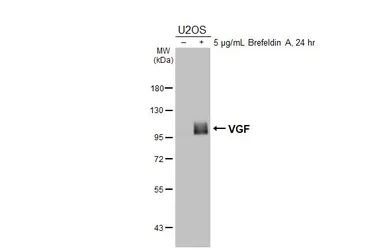 Anti-VGF antibody [HL5755] used in Western Blot (WB). GTX646706