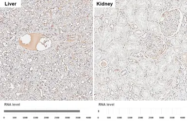 Anti-alpha 1 Antitrypsin antibody [HL5758] used in IHC (Paraffin sections) (IHC-P). GTX646709