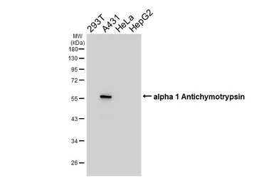 Anti-alpha 1 Antichymotrypsin antibody [HL5759] used in Western Blot (WB). GTX646710
