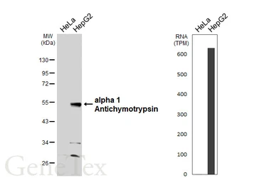 Anti-alpha 1 Antichymotrypsin antibody [HL5762] used in Western Blot (WB). GTX646713