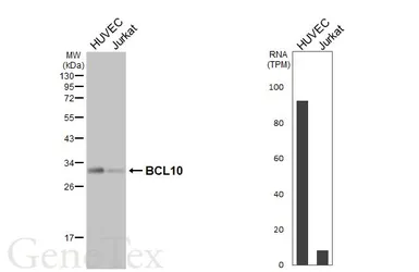 Anti-BCL10 antibody [HL5765] used in Western Blot (WB). GTX646716
