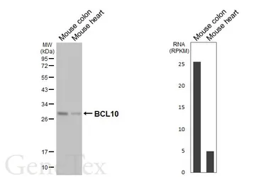 Anti-BCL10 antibody [HL5765] used in Western Blot (WB). GTX646716