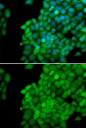 Anti-MAGE 1 antibody used in Immunocytochemistry/ Immunofluorescence (ICC/IF). GTX64672