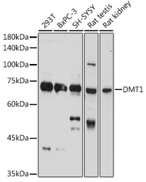 Anti-DMT1 antibody used in Western Blot (WB). GTX64686