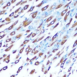 Anti-DMT1 antibody used in IHC (Paraffin sections) (IHC-P). GTX64686