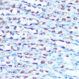 Anti-DMT1 antibody used in IHC (Paraffin sections) (IHC-P). GTX64686