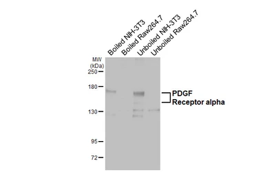 Anti-PDGF Receptor alpha antibody [HL5791] used in Western Blot (WB). GTX646862