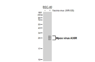 Anti-Mpox virus A35R antibody [HL5804] used in Western Blot (WB). GTX646875