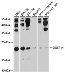 Anti-DUSP14 antibody used in Western Blot (WB). GTX64689