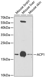 Anti-ACP1 antibody used in Western Blot (WB). GTX64698