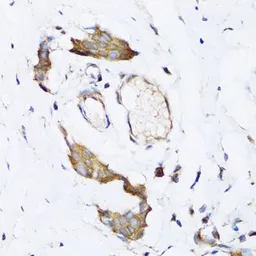 Anti-ARD1A antibody used in IHC (Paraffin sections) (IHC-P). GTX64704
