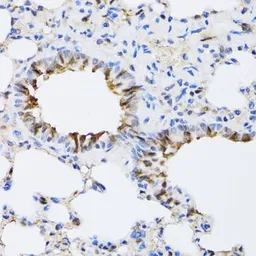 Anti-ARD1A antibody used in IHC (Paraffin sections) (IHC-P). GTX64704