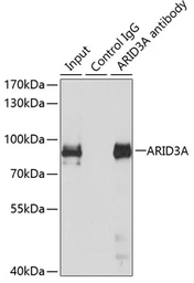 Anti-DRIL1 antibody used in Immunoprecipitation (IP). GTX64706