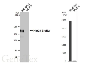 Anti-Her2 / ErbB2 antibody [HL5814] used in Western Blot (WB). GTX647132