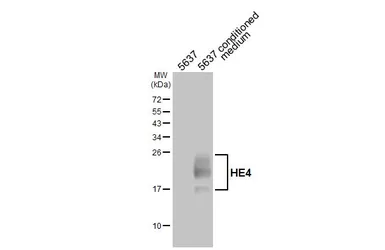Anti-HE4 antibody [HL5819] used in Western Blot (WB). GTX647137