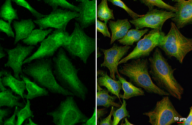 Anti-HAX1 antibody [HL5834] used in Immunocytochemistry/ Immunofluorescence (ICC/IF). GTX647152