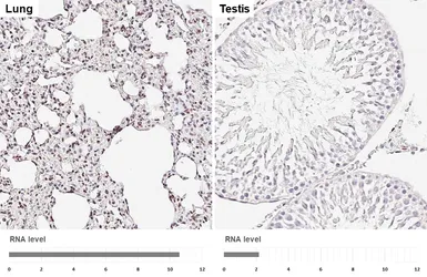Anti-NFIB antibody [HL5837] used in IHC (Paraffin sections) (IHC-P). GTX647155