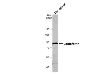 Anti-Lactoferrin antibody [HL5843] used in Western Blot (WB). GTX647161