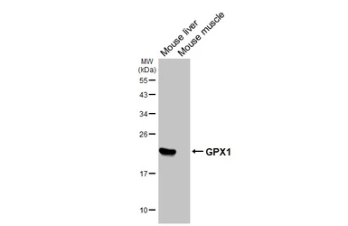 Anti-GPX1 antibody [HL5845] used in Western Blot (WB). GTX647163