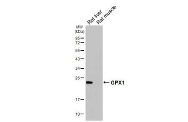 Anti-GPX1 antibody [HL5845] used in Western Blot (WB). GTX647163