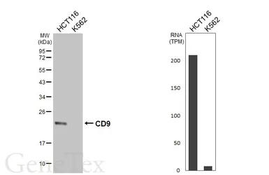 Anti-CD9 antibody [HL5880] used in Western Blot (WB). GTX647204