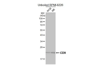 Anti-CD9 antibody [HL5881] used in Western Blot (WB). GTX647205