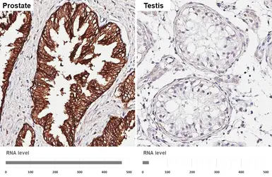 Anti-CD9 antibody [HL5882] used in IHC (Paraffin sections) (IHC-P). GTX647206