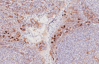 Anti-CD63 antibody [HL5889] used in IHC (Paraffin sections) (IHC-P). GTX647213