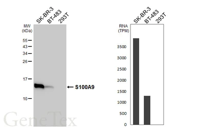 Anti-S100A9 antibody [HL5896] used in Western Blot (WB). GTX647220