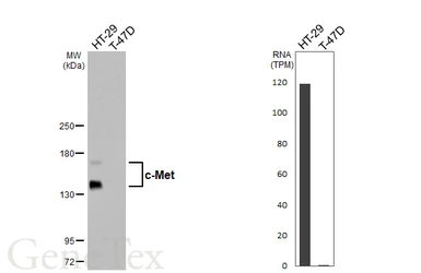 Anti-c-Met antibody [HL5899] used in Western Blot (WB). GTX647223