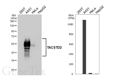 Anti-TACSTD2 antibody [HL5900] used in Western Blot (WB). GTX647224