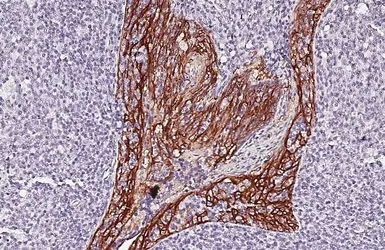 Anti-TACSTD2 antibody [HL5900] used in IHC (Paraffin sections) (IHC-P). GTX647224