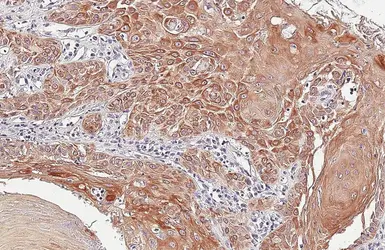 Anti-CD155 antibody [HL5910] used in IHC (Paraffin sections) (IHC-P). GTX647235