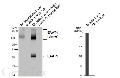 Anti-EAAT1 antibody [HL5912] used in Western Blot (WB). GTX647237